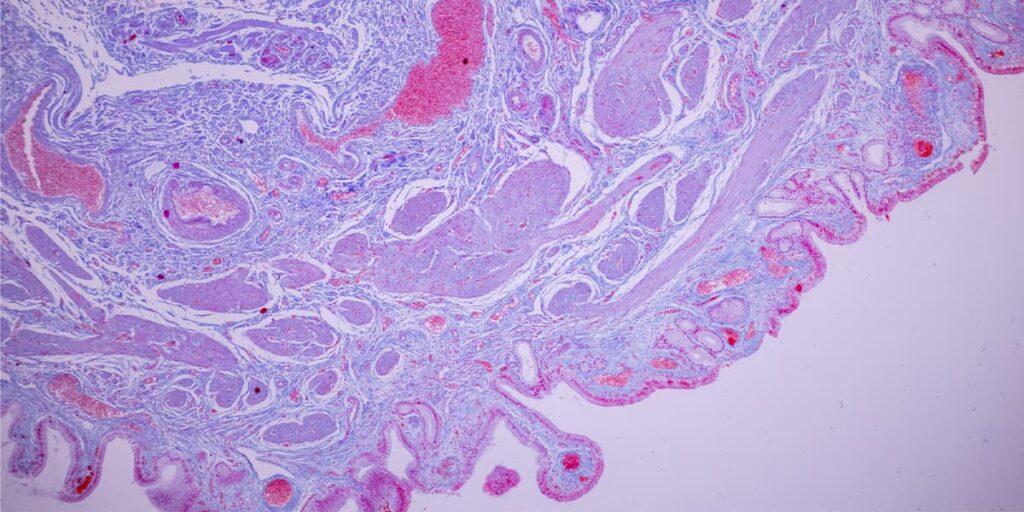 Cells which have been stained using the H&E process. If you ask what is histology, this is a representation of the science.